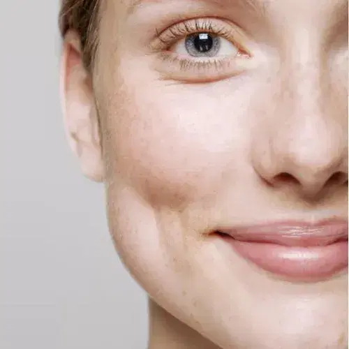 Ceramol Age